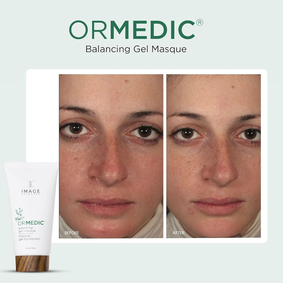 IMAGE Skincare, ORMEDIC Balancing Gel Masque, Helps to Refresh Dry, Tired-Looking Facial Skin, Made with Organic Aloe Vera and Botanical Extracts, 2 fl oz